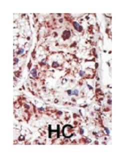 PACSIN1 Rabbit anti-Human, Mouse, Polyclonal Antibody, Abnova 400 &mu;L | Buy Online | Abnova Corporation | Fisher Scientific