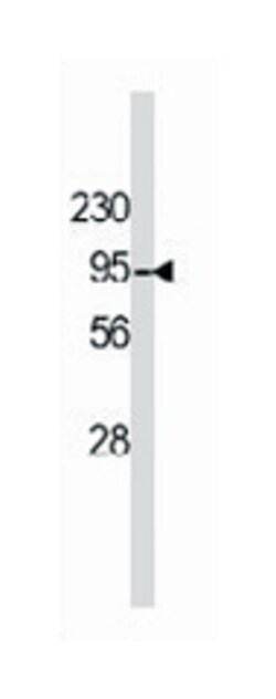 DGKB, Rabbit, Polyclonal Antibody, Abnova 400&mu;L; Unlabeled:Antibodies,