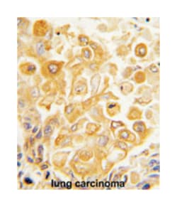 TLR2 Rabbit anti-Human, Polyclonal Antibody, Abnova 400 &mu;L | Buy Online | Abnova Corporation | Fisher Scientific