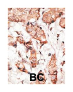 STAT2 Rabbit anti-Human, Polyclonal Antibody, Abnova 400 &mu;L | Buy Online | Abnova Corporation | Fisher Scientific