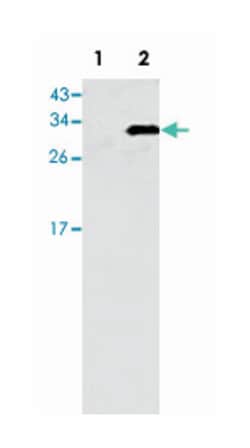 GJB6, Rabbit, Polyclonal Antibody, Abnova 400 &mu;L | Buy Online | Abnova | Fisher Scientific
