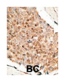 BMP10, Rabbit, Polyclonal Antibody, Abnova 400 &mu;L | Buy Online | Abnova Corporation | Fisher Scientific