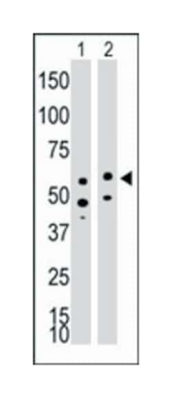 BMPR1A Rabbit anti-Human, Mouse, Polyclonal Antibody, Abnova 400 &mu;L | Buy Online | Abnova Corporation | Fisher Scientific