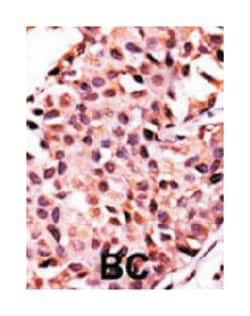 PPP3CC Rabbit anti-Human, Polyclonal Antibody, Abnova 400 &mu;L | Buy Online | Abnova Corporation | Fisher Scientific