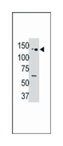 USP25 Rabbit anti-Human, Polyclonal Antibody, Abnova 400&mu;L; Unlabeled:Antibodies,
