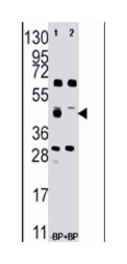 FDFT1, Rabbit, Polyclonal Antibody, Abnova 400&mu;L; Unlabeled:Antibodies,