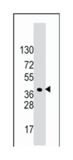 HDGF, Rabbit, Polyclonal Antibody, Abnova 400 &mu;L | Buy Online | Abnova | Fisher Scientific