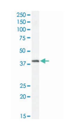FXYD5, Goat, Polyclonal Antibody, Abnova 100 &mu;g | Buy Online | Abnova Corporation | Fisher Scientific