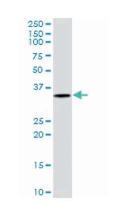 VDAC2 Goat anti-Human, Polyclonal Antibody, Abnova 100&mu;g; Unlabeled:Antibodies,