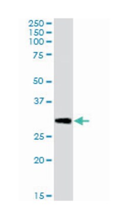 Dcdc2a, Goat, Polyclonal Antibody, Abnova 100 &mu;g | Buy Online | Abnova Corporation | Fisher Scientific
