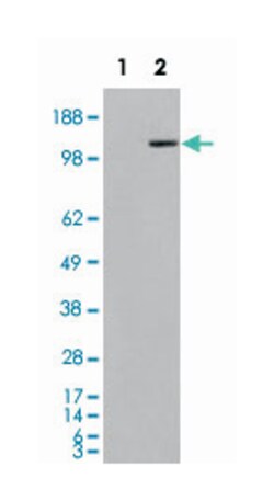 MAN2A1, Goat, Polyclonal Antibody, Abnova 100&mu;g; Unlabeled:Antibodies,