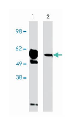 FBXW7, Rabbit, Polyclonal Antibody, Abnova 100&mu;g; Unlabeled:Antibodies,