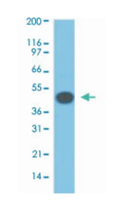 KRT18, Mouse, Clone: DA7, Abnova 100 &mu;g | Buy Online | Abnova Corporation | Fisher Scientific