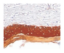 Pan Cytokeratin, Mouse, Clone: AE1 + AE3, Abnova 100&mu;g; Unlabeled:Antibodies,