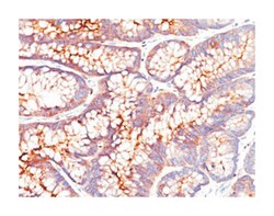 CEACAM5, Mouse, Clone: CEA31, Abnova 100&mu;g; Unlabeled:Antibodies, Monoclonal