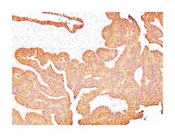 EPCAM, Mouse, Clone: 323/A3, Abnova 100&mu;g; Unlabeled:Antibodies, Monoclonal