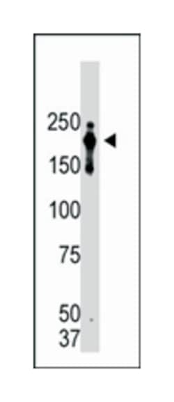 PRDM2, Mouse, Clone: 33AT1045, Abnova 400 &mu;L | Buy Online | Abnova Corporation | Fisher Scientific