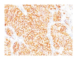 CA9, Mouse, Clone: SPM314, Abnova 100&mu;g; Unlabeled:Antibodies, Monoclonal