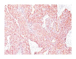 CHGA, Mouse, Clone: SPM585, Abnova 100&mu;g; Unlabeled:Antibodies, Monoclonal