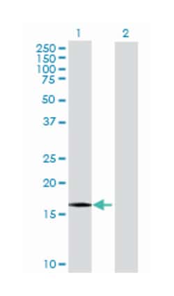 endothelial differentiation-related factor 1 (B02), Mouse anti-Human, Polyclonal Antibody, Abnova 50 &mu;L | Buy Online | Abnova Corporation | Fisher Scientific