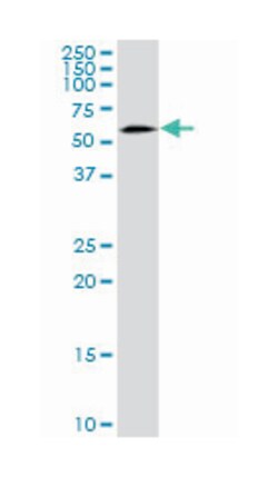 sorting nexin 4, Mouse, Purified MaxPab Polyclonal Antibody, Abnova 50&mu;g;