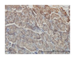 receptor-interacting serine-threonine kinase 2, Mouse, Clone: 7F5, Abnova