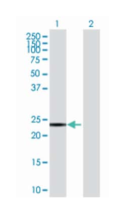 synaptosomal-associated protein, 23kDa, Mouse, Polyclonal Antibody, Abnova