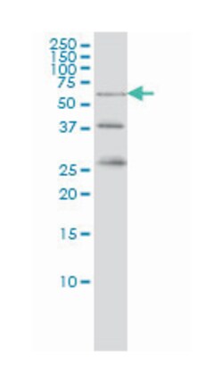 RIO kinase 3 (yeast), Mouse, Clone: 3G11, Abnova 100&mu;g; Unlabeled:Antibodies,