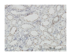 cyclin-dependent kinase-like 1 (CDC2-related kinase), Mouse, Clone: 1F12,