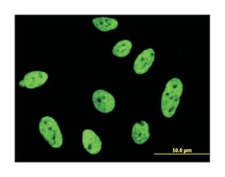 cyclin-dependent kinase-like 1 (CDC2-related kinase), Mouse, Clone: 1F12,