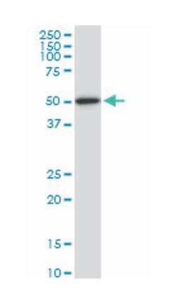histone deacetylase 3, Mouse, Clone: 2A3, Abnova 100&mu;g; Unlabeled:Anticuerpos