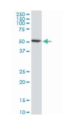 histone deacetylase 3, Mouse, Clone: 2A3, Abnova 100&mu;g; Unlabeled:Anticuerpos
