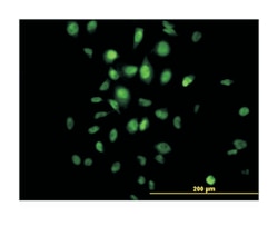 histone deacetylase 3, Mouse, Clone: 2A3, Abnova 100&mu;g; Unlabeled:Anticuerpos