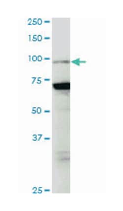 K(lysine) acetyltransferase 2B, Mouse, Clone: 5E11, Abnova 100&mu;g; Unlabeled:Anticorps,