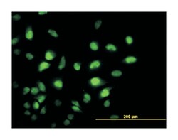 K(lysine) acetyltransferase 2B, Mouse, Clone: 5E11, Abnova 100&mu;g; Unlabeled:Anticorps,