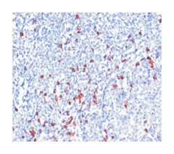 IGHG1, Mouse, Clone: SPM556, Abnova 100&mu;g; Unlabeled:Antibodies, Monoclonal