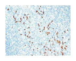 IGHM, Mouse, Clone: SPM557, Abnova 100&mu;g; Unlabeled:Antibodies, Monoclonal