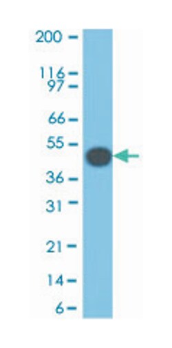 KRT18, Mouse, Clone: SPM510, Abnova 100 &mu;g | Buy Online | Abnova | Fisher Scientific