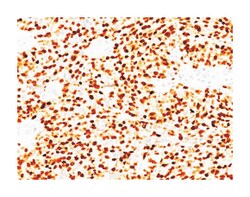 MYOD1, Mouse, Clone: MYD712, Abnova 100&mu;g; Unlabeled:Antibodies, Monoclonal