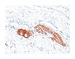 NCAM1, Mouse, Clone: 123A8, Abnova 100&mu;g; Unlabeled:Antibodies, Monoclonal