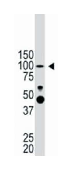 PROX1 Rabbit anti-Human, Mouse, Polyclonal Antibody, Abnova 400&mu;L; Unlabeled:Antibodies,