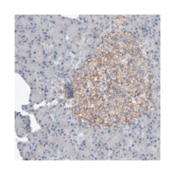 PGBD2 Rabbit anti-Human, Polyclonal Antibody, Abnova 100 &mu;L | Buy Online | Abnova Corporation | Fisher Scientific