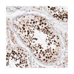 CDCA2 Rabbit anti-Human, Polyclonal Antibody, Abnova 100&mu;L; Unlabeled:Antibodies,