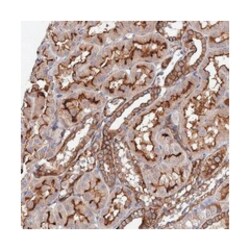ITPKA Rabbit anti-Human, Polyclonal Antibody, Abnova 100 &mu;L | Buy Online | Abnova Corporation | Fisher Scientific