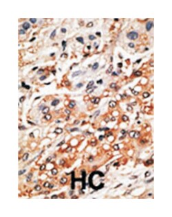BMF Rabbit anti-Human, Polyclonal Antibody, Abnova 400 &mu;L | Buy Online | Abnova Corporation | Fisher Scientific
