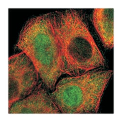 PSMD5, Rabbit, Polyclonal Antibody, Abnova 100 &mu;L | Buy Online | Abnova Corporation | Fisher Scientific
