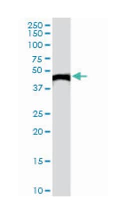 CKB, Goat, Polyclonal Antibody, Abnova 100&mu;g; Unlabeled:Antibodies,