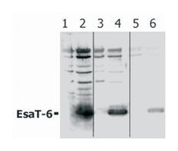 Mycobacterium tuberculosis EsaT-6 (Rv3875), Rabbit, Polyclonal Antibody,