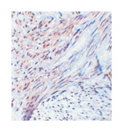 TRIM5 Rabbit anti-Human, Monkey, Polyclonal Antibody, Abnova 100&mu;g;