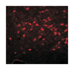 CHAT Rabbit anti-Guinea pig, Mouse, Pig, Rabbit, Rat, Polyclonal Antibody,